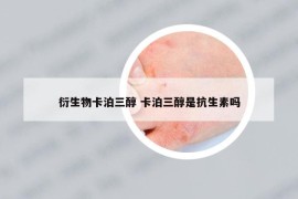 衍生物卡泊三醇 卡泊三醇是抗生素吗
