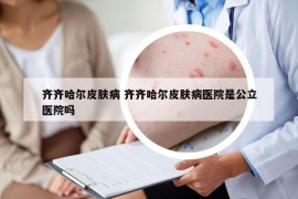 齐齐哈尔皮肤病 齐齐哈尔皮肤病医院是公立医院吗
