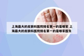 上海最大的皮肤科医院排名第一的是哪家 上海最大的皮肤科医院排名第一的是哪家医生