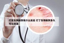 打完生物制剂有什么反应 打了生物制剂多久可以洗澡