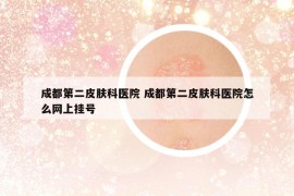 成都第二皮肤科医院 成都第二皮肤科医院怎么网上挂号