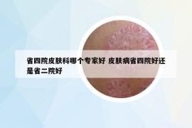 省四院皮肤科哪个专家好 皮肤病省四院好还是省二院好