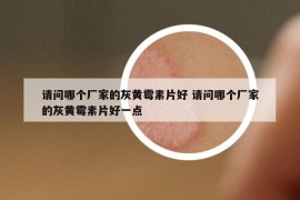 请问哪个厂家的灰黄霉素片好 请问哪个厂家的灰黄霉素片好一点