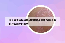 湖北省看皮肤病最好的医院是哪家 湖北皮肤科排名前十的医院