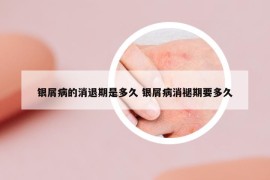 银屑病的消退期是多久 银屑病消褪期要多久