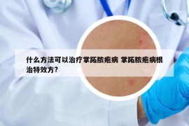 什么方法可以治疗掌跖脓疱病 掌跖脓疱病根治特效方?