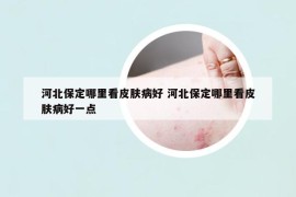 河北保定哪里看皮肤病好 河北保定哪里看皮肤病好一点