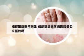 成都银康医院医生 成都银康银屑病医院是公立医院吗