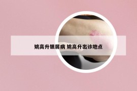 姚高升银屑病 姚高升出诊地点