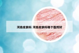 河南皮肤科 河南皮肤科哪个医院好