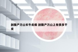 剖腹产刀口长牛皮癣 剖腹产刀口上有很多干皮