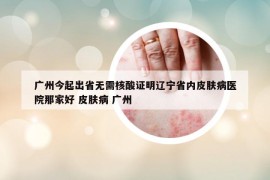 广州今起出省无需核酸证明辽宁省内皮肤病医院那家好 皮肤病 广州