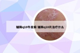 辅酶q10牛皮癣 辅酶q10片治疗什么