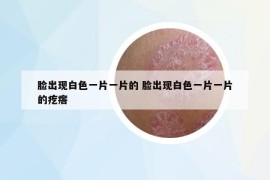 脸出现白色一片一片的 脸出现白色一片一片的疙瘩