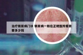 治疗银屑病门诊 银屑病一般在正规医院看需要多少钱