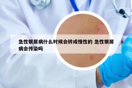 急性银屑病什么时候会转成慢性的 急性银屑病会传染吗