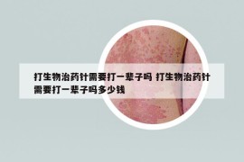 打生物治药针需要打一辈子吗 打生物治药针需要打一辈子吗多少钱