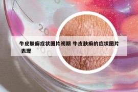 牛皮肤癣症状图片初期 牛皮肤癣的症状图片 表现