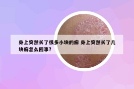 身上突然长了很多小块的癣 身上突然长了几块癣怎么回事?