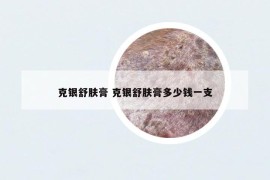 克银舒肤膏 克银舒肤膏多少钱一支