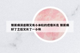 银屑病消退期又有小米粒的疙瘩长出 银屑病好了之后又长了一小块