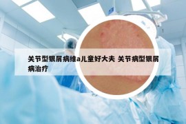 关节型银屑病维a儿童好大夫 关节病型银屑病治疗