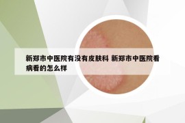 新郑市中医院有没有皮肤科 新郑市中医院看病看的怎么样