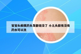 宝宝头癣摸药头发都烧没了 小儿头藓有没有药水可以洗