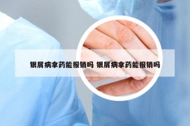 银屑病拿药能报销吗 银屑病拿药能报销吗