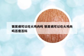 银屑病可以吃火鸡肉吗 银屑病可以吃火鸡肉吗百度百科