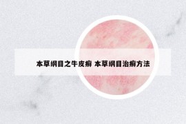 本草纲目之牛皮癣 本草纲目治癣方法
