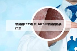 银屑病2023提案 2020年银屑病最新疗法