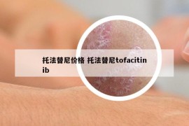 托法替尼价格 托法替尼tofacitinib