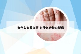 为什么会长白斑 为什么会长白斑病