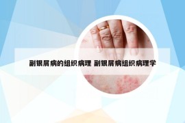 副银屑病的组织病理 副银屑病组织病理学