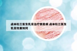 卤米松三氯生乳膏治疗银屑病 卤米松三氯生乳膏效果如何