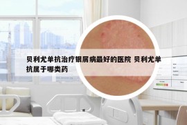 贝利尤单抗治疗银屑病最好的医院 贝利尤单抗属于哪类药