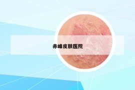 赤峰皮肤医院