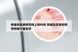 四道街皮肤研究所上班时间 四道街皮肤科研究所哪个医生好