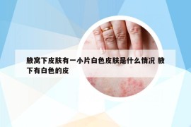 腋窝下皮肤有一小片白色皮肤是什么情况 腋下有白色的皮