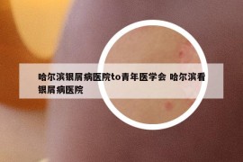 哈尔滨银屑病医院to青年医学会 哈尔滨看银屑病医院