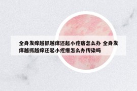 全身发痒越抓越痒还起小疙瘩怎么办 全身发痒越抓越痒还起小疙瘩怎么办传染吗