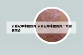 去胎记哪家医院好 去胎记哪家医院好广州健肤简介