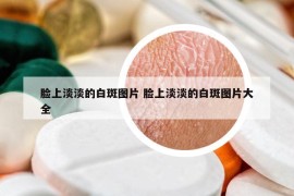 脸上淡淡的白斑图片 脸上淡淡的白斑图片大全