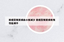 脓疱型银屑病血小板减少 脓疱型银屑病有慢性起病不