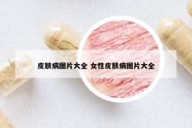 皮肤病图片大全 女性皮肤病图片大全