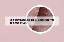 可善挺密集针都是10针么 可善挺密集针打完没痊愈怎么办