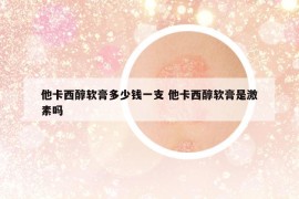 他卡西醇软膏多少钱一支 他卡西醇软膏是激素吗