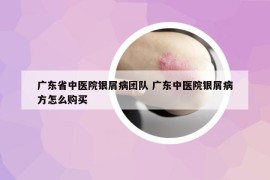 广东省中医院银屑病团队 广东中医院银屑病方怎么购买