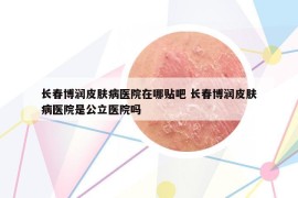 长春博润皮肤病医院在哪贴吧 长春博润皮肤病医院是公立医院吗